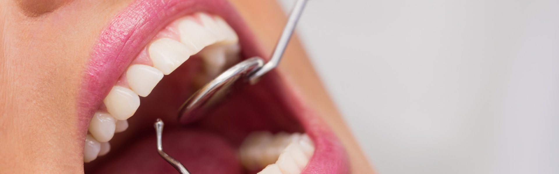 Fogászati korona Budapesten